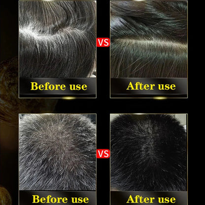 (Pack of 2) 3-in-1 Black Hair Dye Shampoo – Hair Colour Shampoo for Men & Women